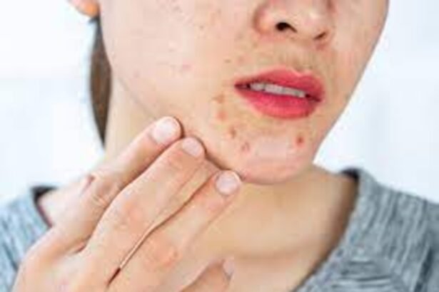 How to Spot Skin Cancer Using the 'Ugly Duckling Rule' Amid UK Heatwave